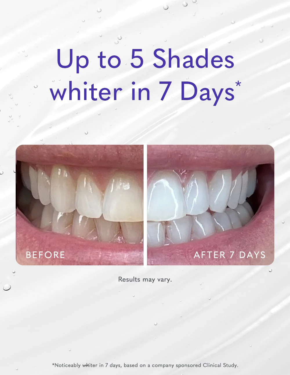 Teeth Whitening Gel (2oz) - Image 7